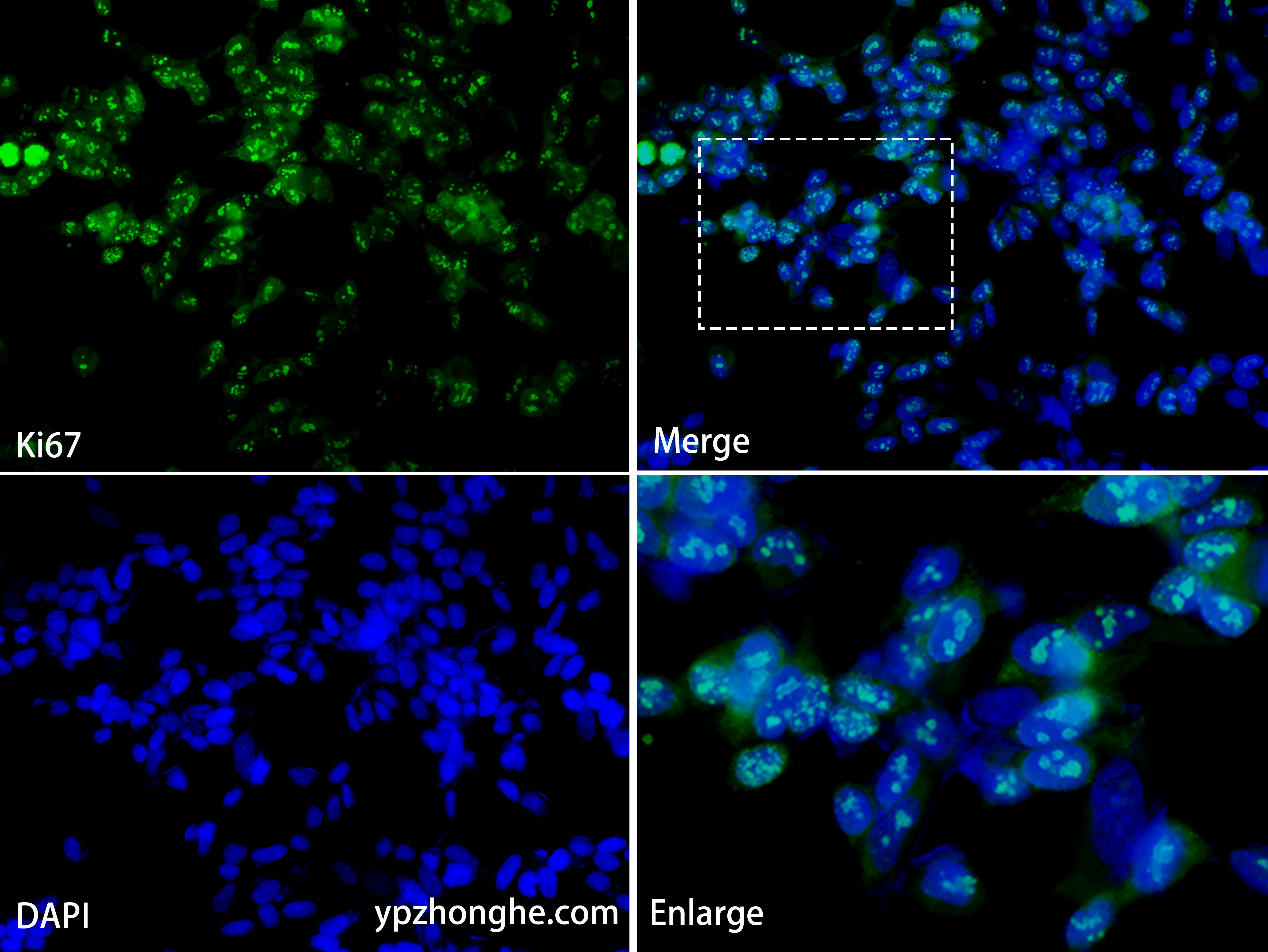 Recombinant Ki67 Rabbit Monoclonal Antibody - 一品众合官网